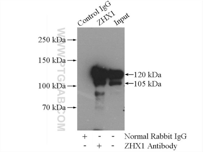 ZHX1 Antibody in Immunoprecipitation (IP)