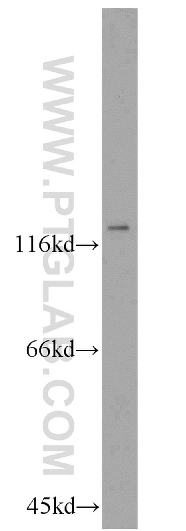 ZHX1 Antibody in Western Blot (WB)