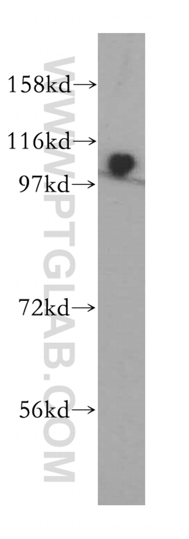 ZHX1 Antibody in Western Blot (WB)