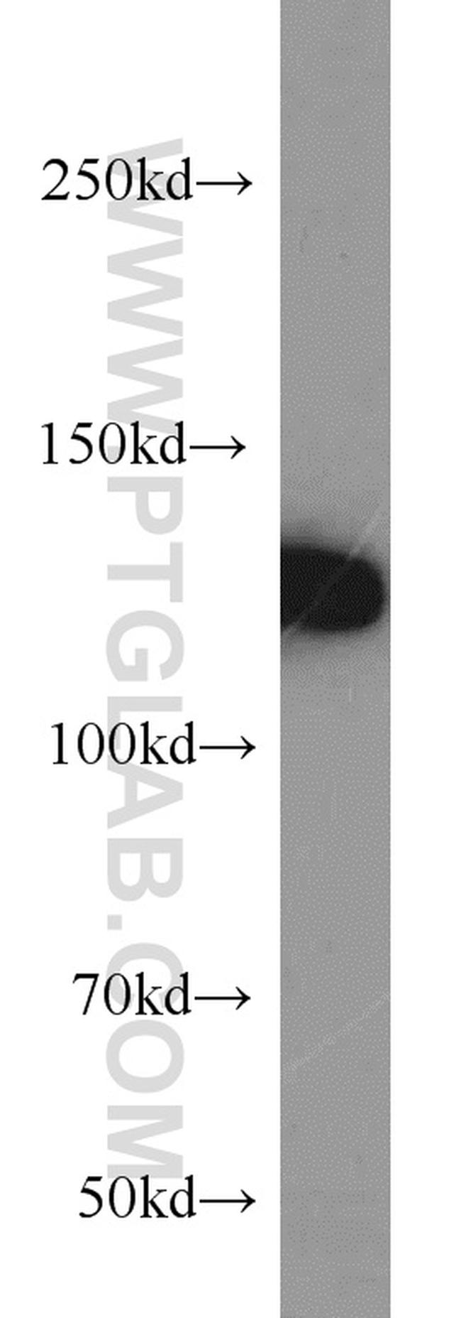 ZHX1 Antibody in Western Blot (WB)