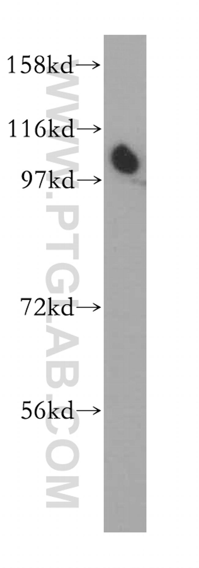 ZHX1 Antibody in Western Blot (WB)