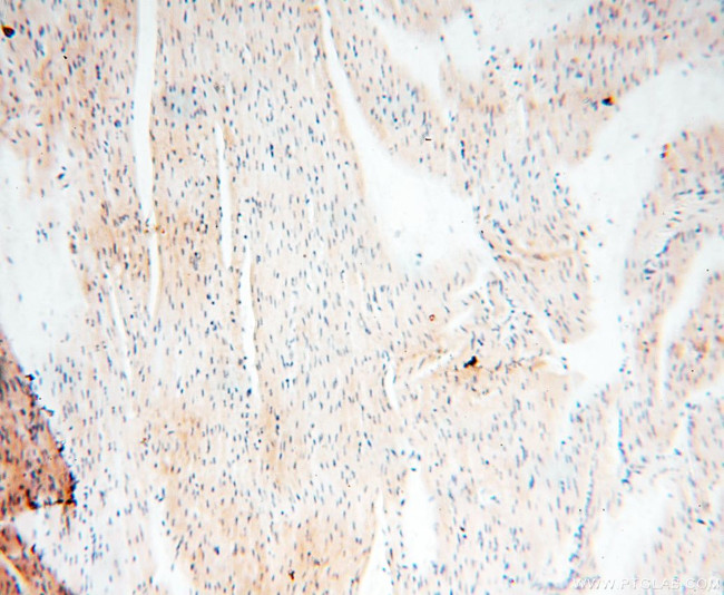 AKAP3 Antibody in Immunohistochemistry (Paraffin) (IHC (P))