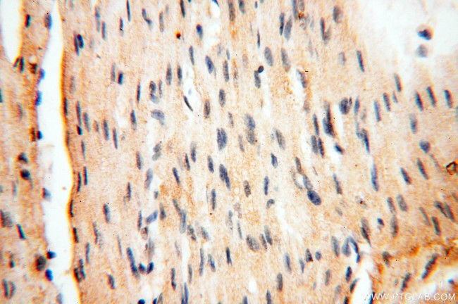 AKAP3 Antibody in Immunohistochemistry (Paraffin) (IHC (P))