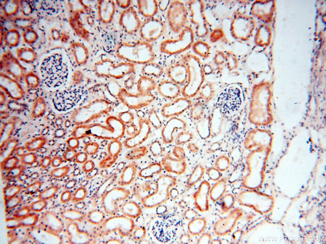 AKAP3 Antibody in Immunohistochemistry (Paraffin) (IHC (P))