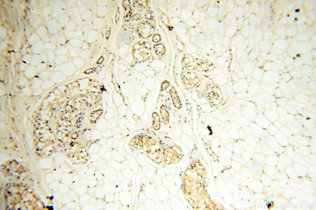 AKAP3 Antibody in Immunohistochemistry (Paraffin) (IHC (P))