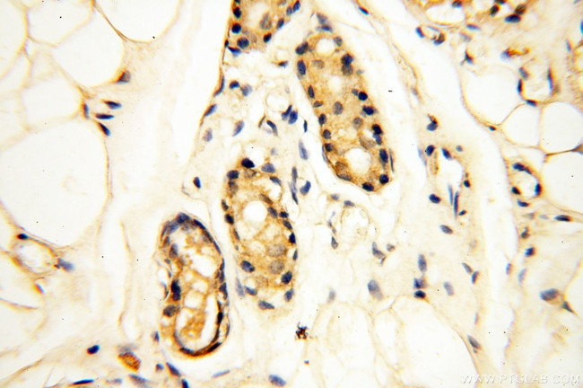 AKAP3 Antibody in Immunohistochemistry (Paraffin) (IHC (P))