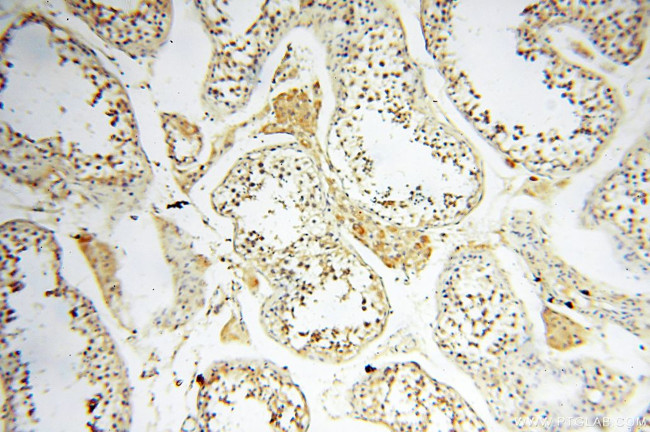 AKAP3 Antibody in Immunohistochemistry (Paraffin) (IHC (P))