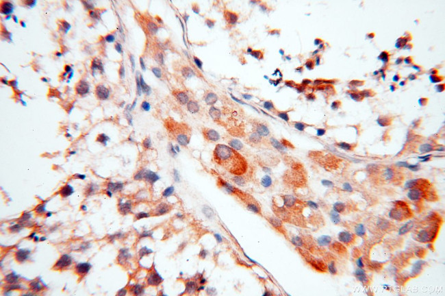 AKAP3 Antibody in Immunohistochemistry (Paraffin) (IHC (P))