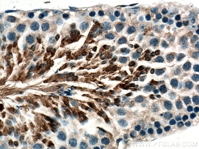 AKAP3 Antibody in Immunohistochemistry (Paraffin) (IHC (P))