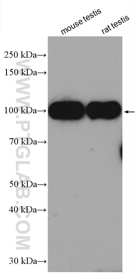 AKAP3 Antibody in Western Blot (WB)