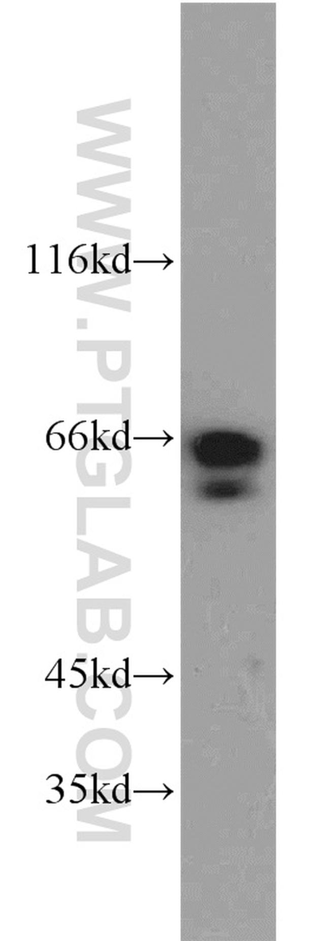 SODD/BAG4 Antibody in Western Blot (WB)