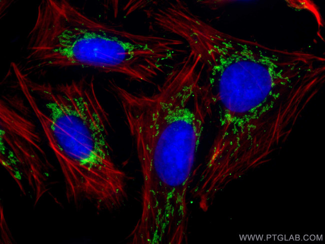 SNN Antibody in Immunocytochemistry (ICC/IF)