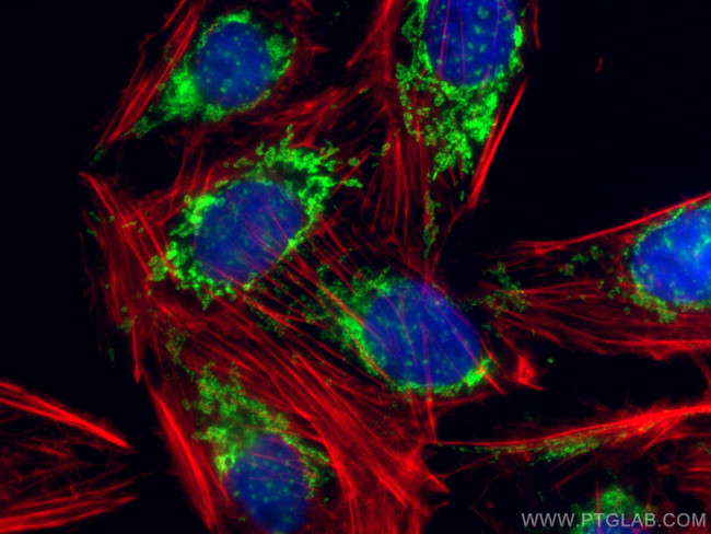 SNN Antibody in Immunocytochemistry (ICC/IF)