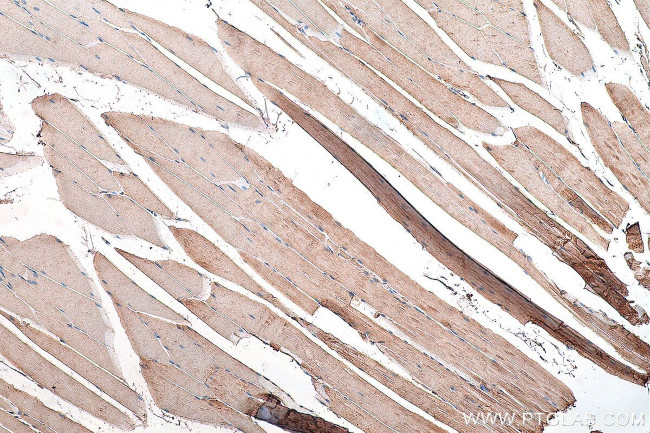 SNN Antibody in Immunohistochemistry (Paraffin) (IHC (P))