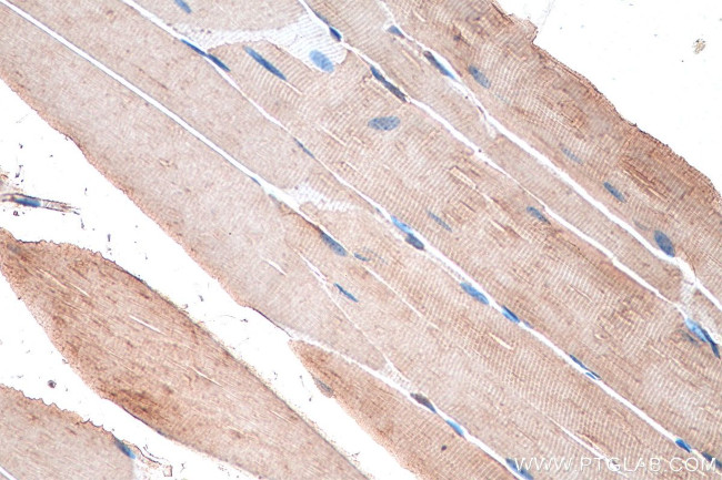 SNN Antibody in Immunohistochemistry (Paraffin) (IHC (P))