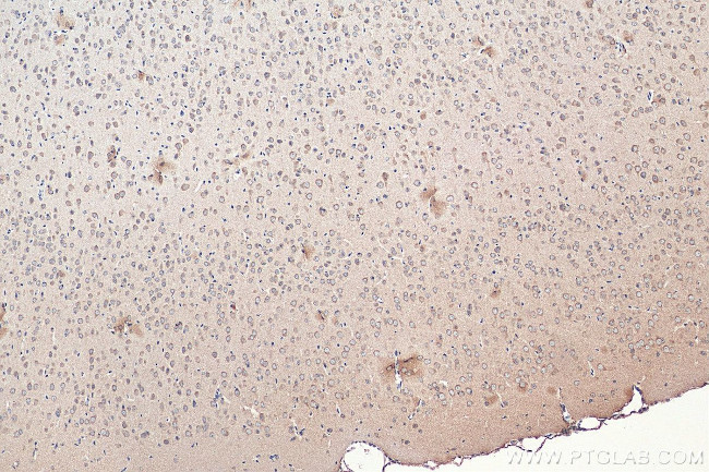 SNN Antibody in Immunohistochemistry (Paraffin) (IHC (P))