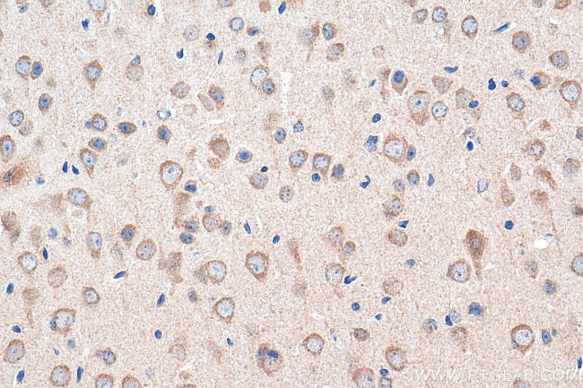 SNN Antibody in Immunohistochemistry (Paraffin) (IHC (P))