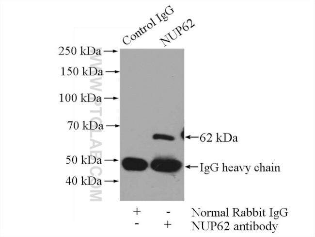 NUP62 Antibody in Immunoprecipitation (IP)