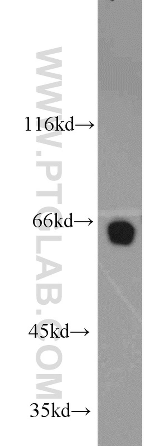 NUP62 Antibody in Western Blot (WB)