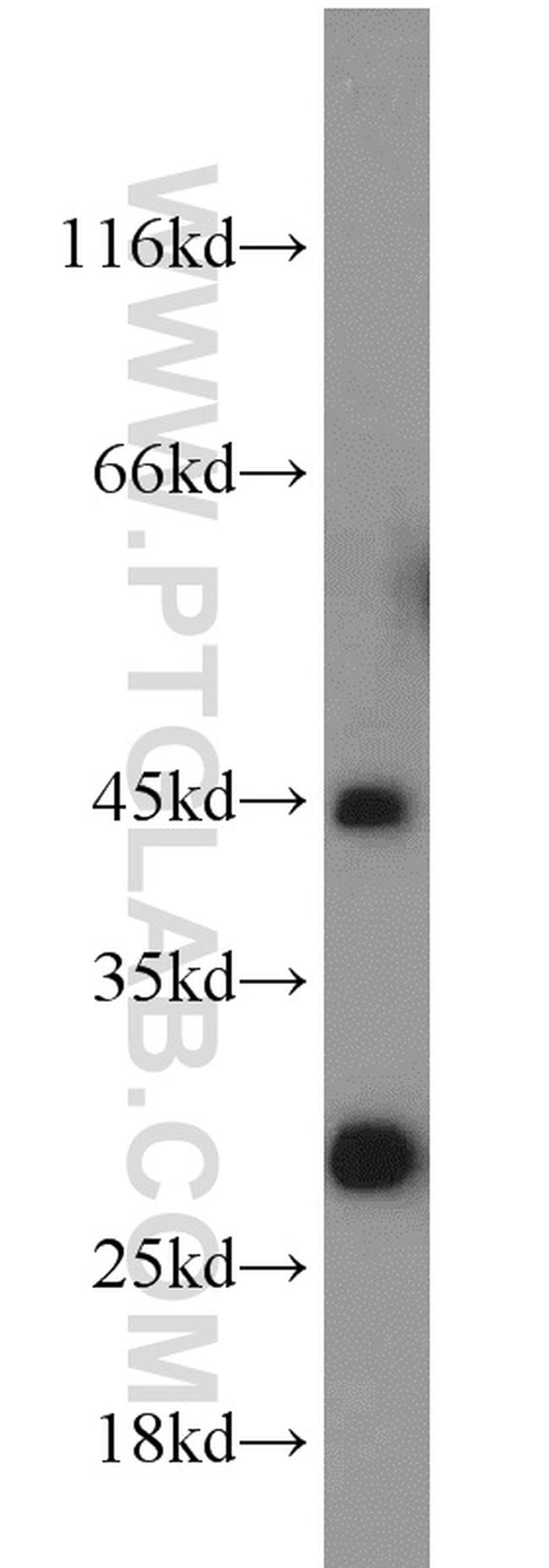 HORMAD1 Antibody in Western Blot (WB)