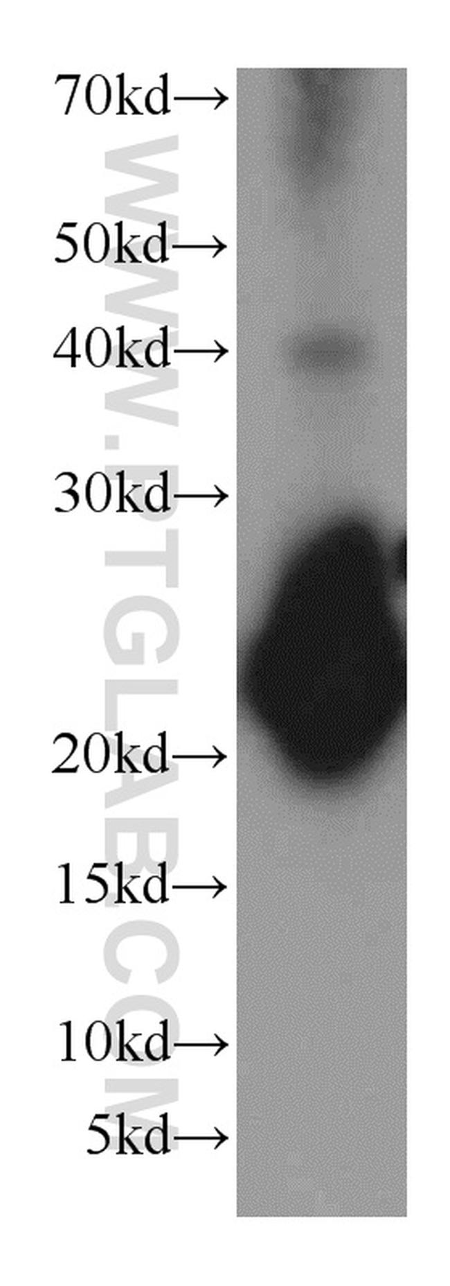 VILIP-1 Antibody in Western Blot (WB)