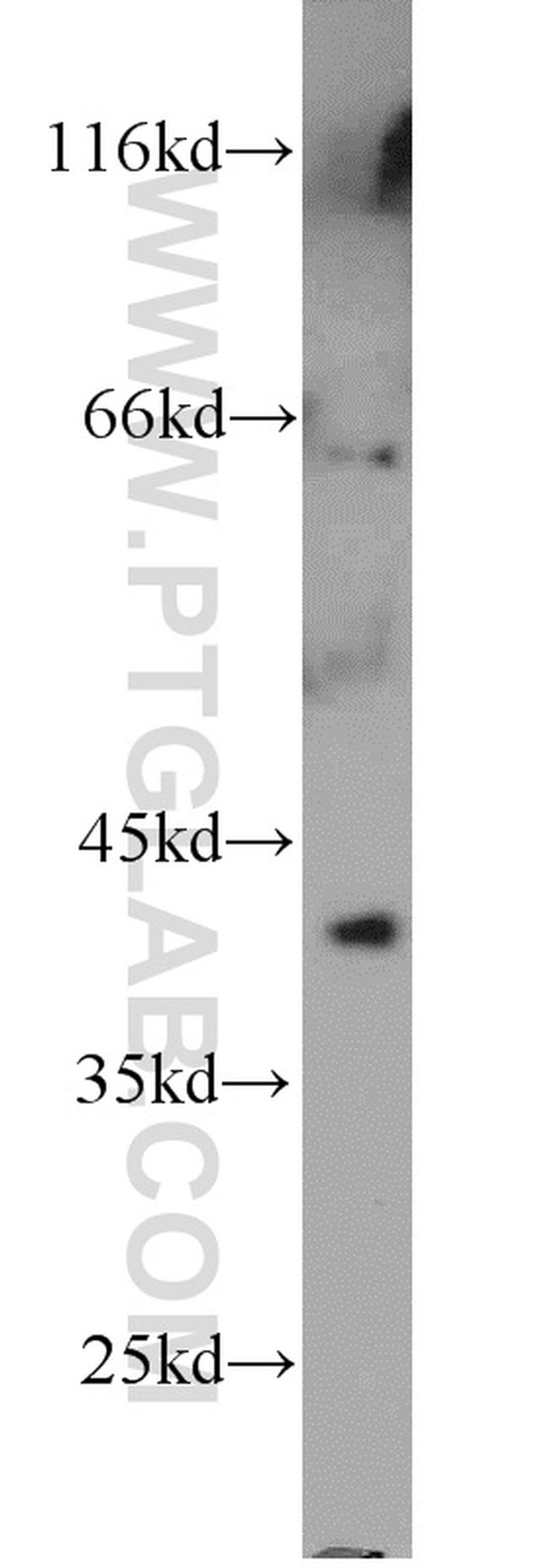 NKX2-5 Antibody in Western Blot (WB)