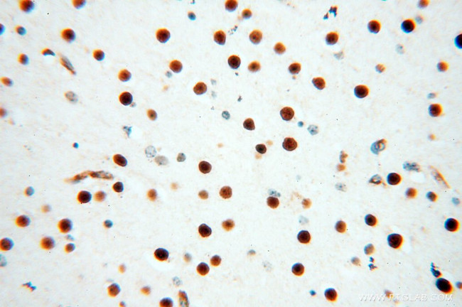 NKX2-5 Antibody in Immunohistochemistry (Paraffin) (IHC (P))