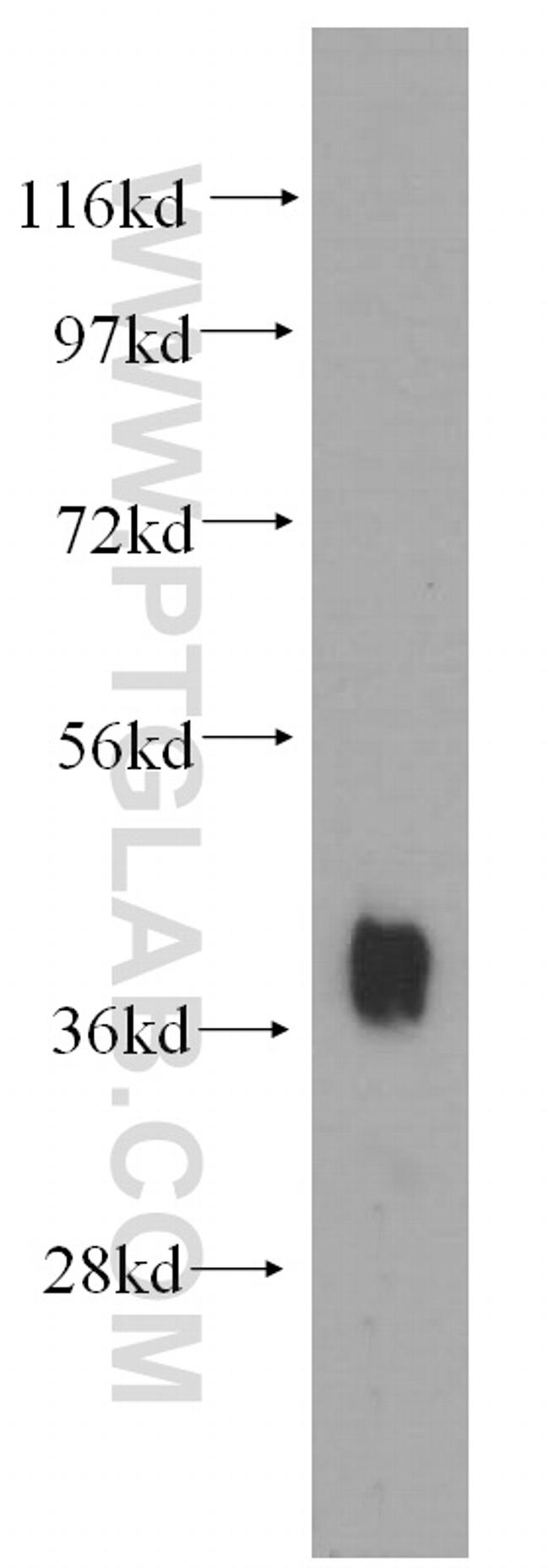 NKX2-5 Antibody in Western Blot (WB)