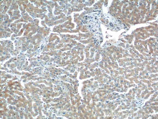 PTPRE Antibody in Immunohistochemistry (Paraffin) (IHC (P))