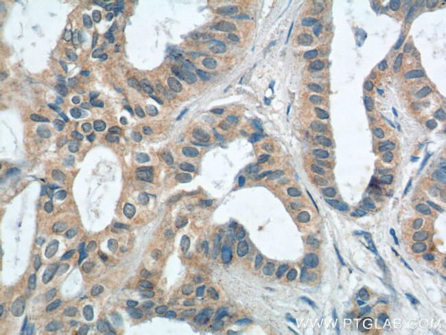 PTPRE Antibody in Immunohistochemistry (Paraffin) (IHC (P))