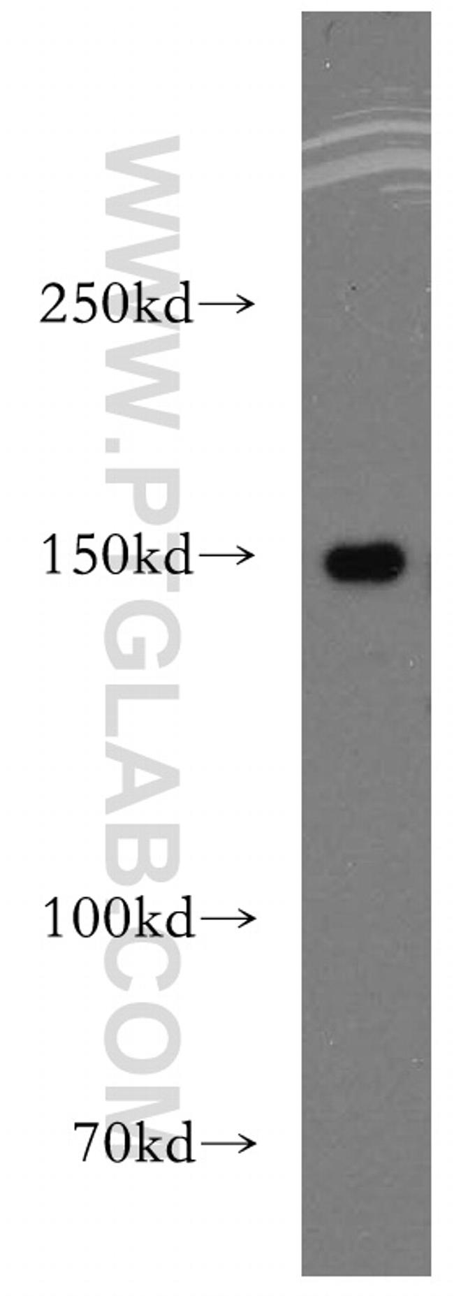 DHX29 Antibody in Western Blot (WB)