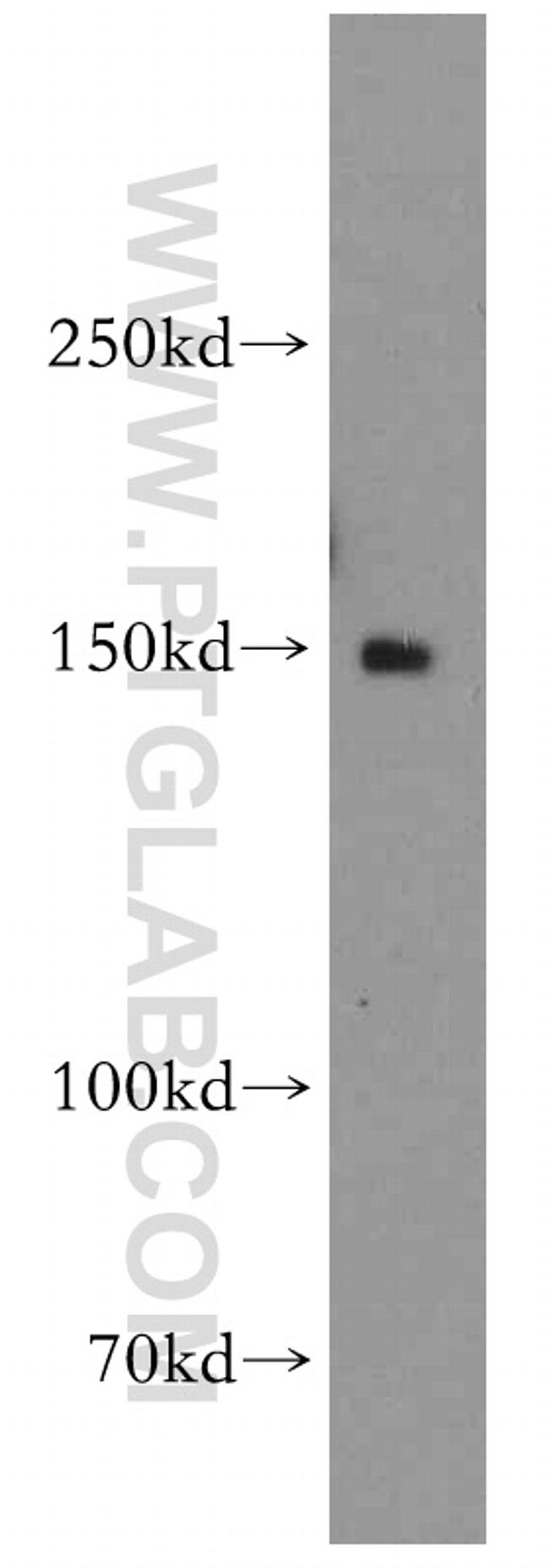 DHX29 Antibody in Western Blot (WB)
