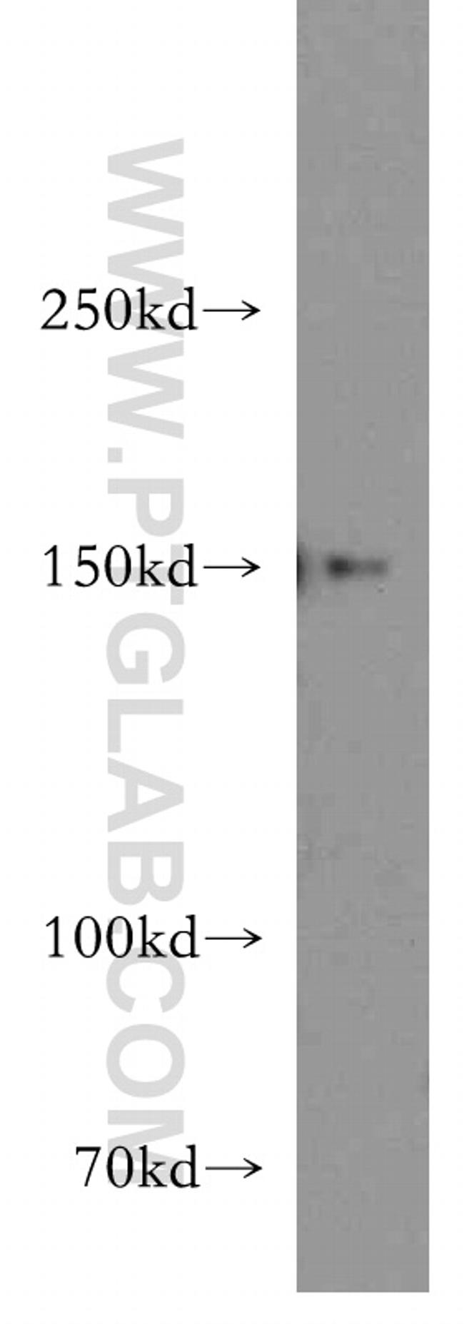 DHX29 Antibody in Western Blot (WB)