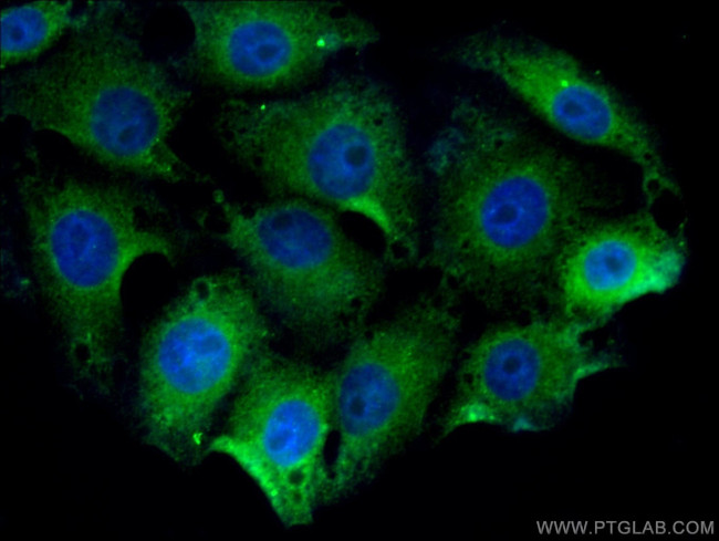 DCX Antibody in Immunocytochemistry (ICC/IF)