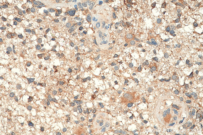 DCX Antibody in Immunohistochemistry (Paraffin) (IHC (P))