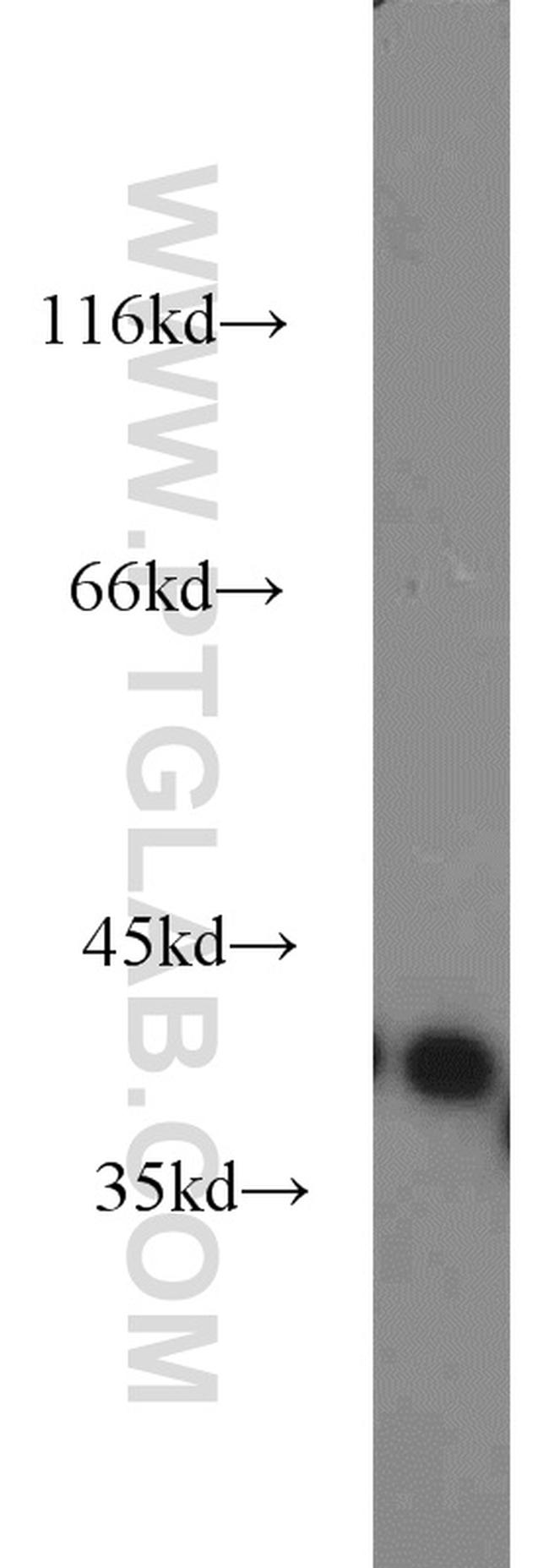 DCX Antibody in Western Blot (WB)