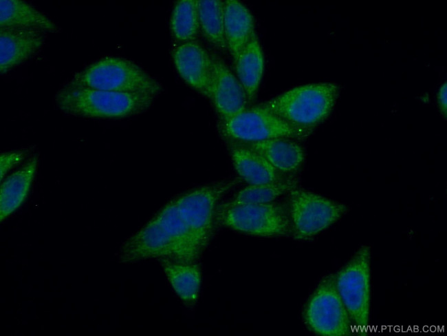 NPC1 Antibody in Immunocytochemistry (ICC/IF)