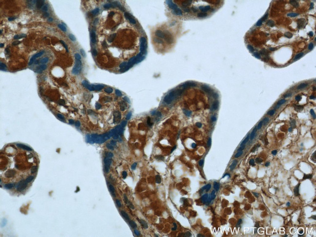 NPC1 Antibody in Immunohistochemistry (Paraffin) (IHC (P))