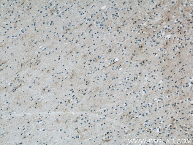 NPC1 Antibody in Immunohistochemistry (Paraffin) (IHC (P))