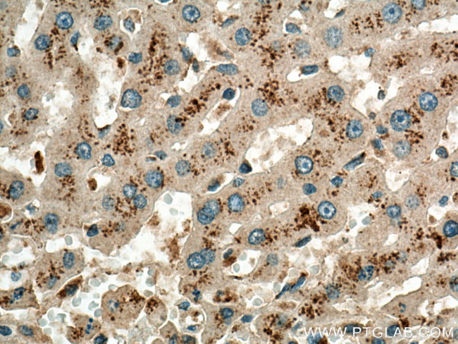 NPC1 Antibody in Immunohistochemistry (Paraffin) (IHC (P))