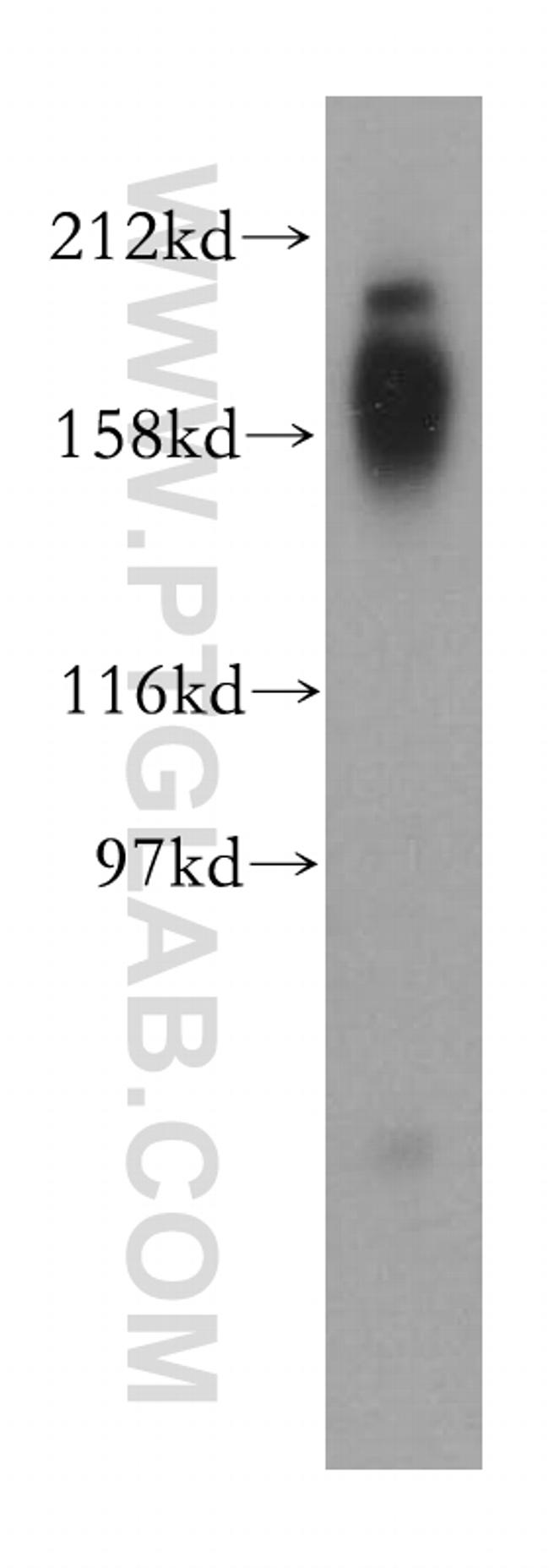 NPC1 Antibody in Western Blot (WB)