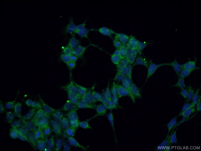 GNAQ Antibody in Immunocytochemistry (ICC/IF)