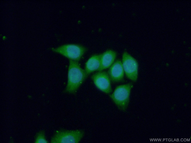 GNAQ Antibody in Immunocytochemistry (ICC/IF)