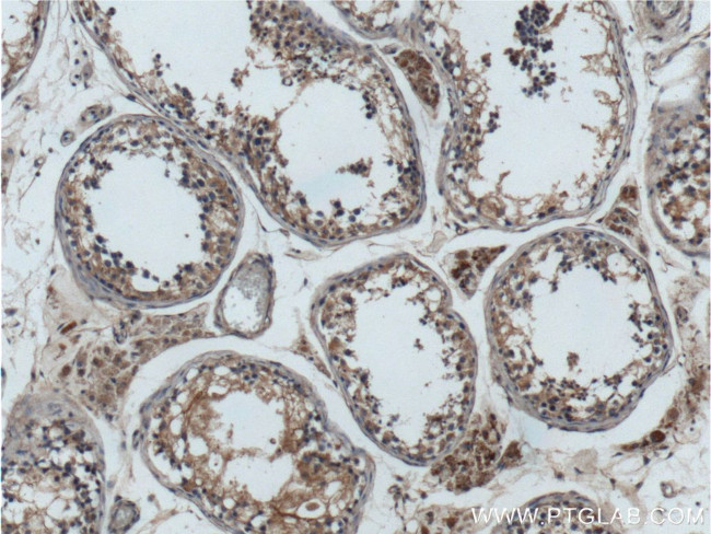 GNAQ Antibody in Immunohistochemistry (Paraffin) (IHC (P))