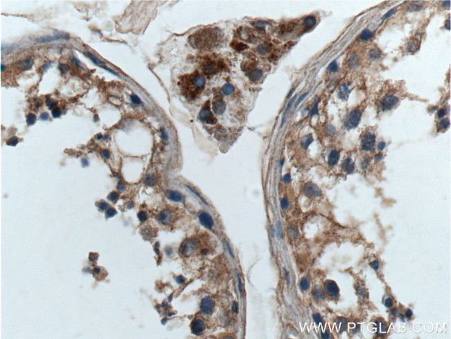 GNAQ Antibody in Immunohistochemistry (Paraffin) (IHC (P))