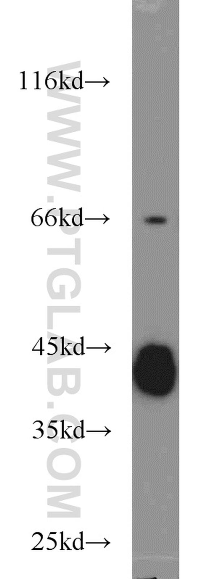 GNAQ Antibody in Western Blot (WB)