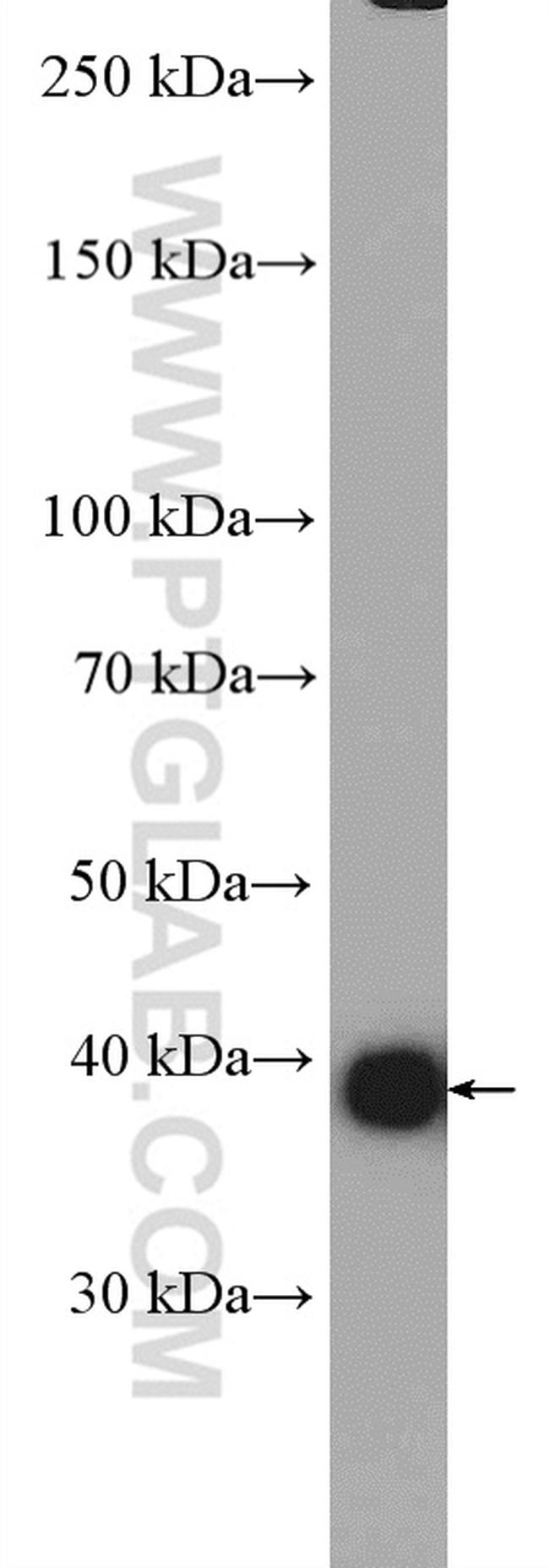 GNAQ Antibody in Western Blot (WB)