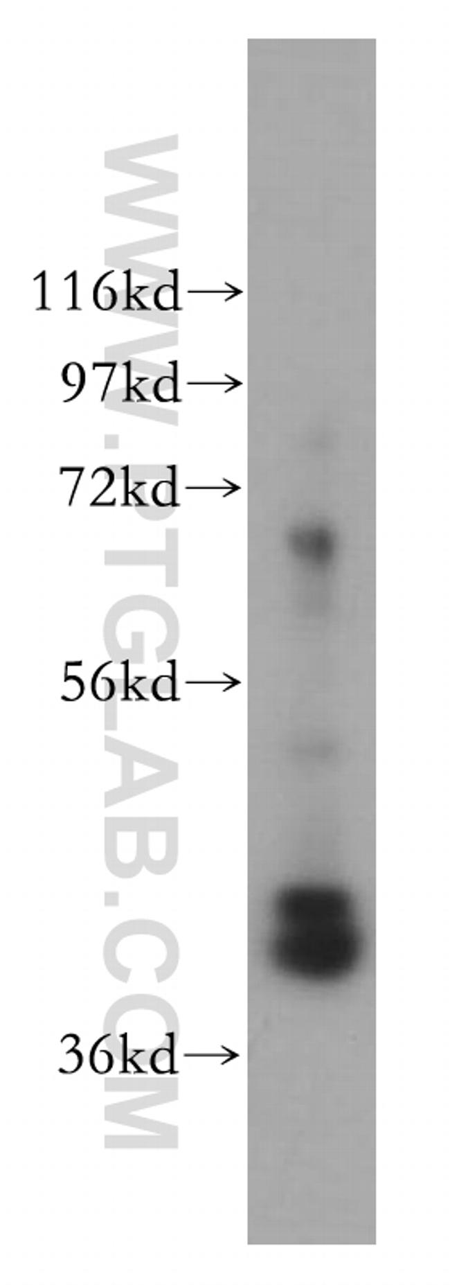 GNAQ Antibody in Western Blot (WB)