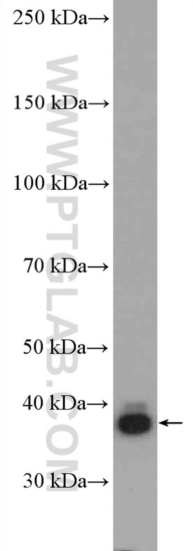 GNAQ Antibody in Western Blot (WB)