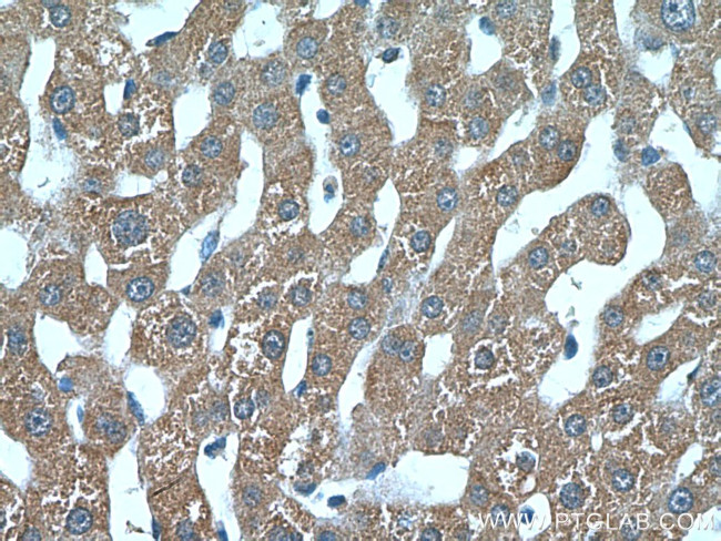 MDP-1 Antibody in Immunohistochemistry (Paraffin) (IHC (P))